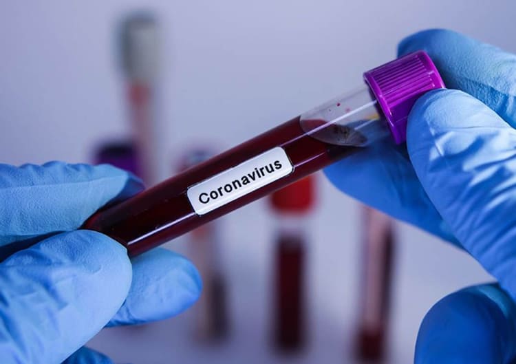 Site da Granja Viana - 😉⁣O Lavoisier Carapicuíba já tem disponível teste  COVID-19 (PCR) e Sorologia para pacientes com sintomas.⠀ ⠀ ⠀ OS Exames  podem ser realizados apenas na Unidade da Avenida